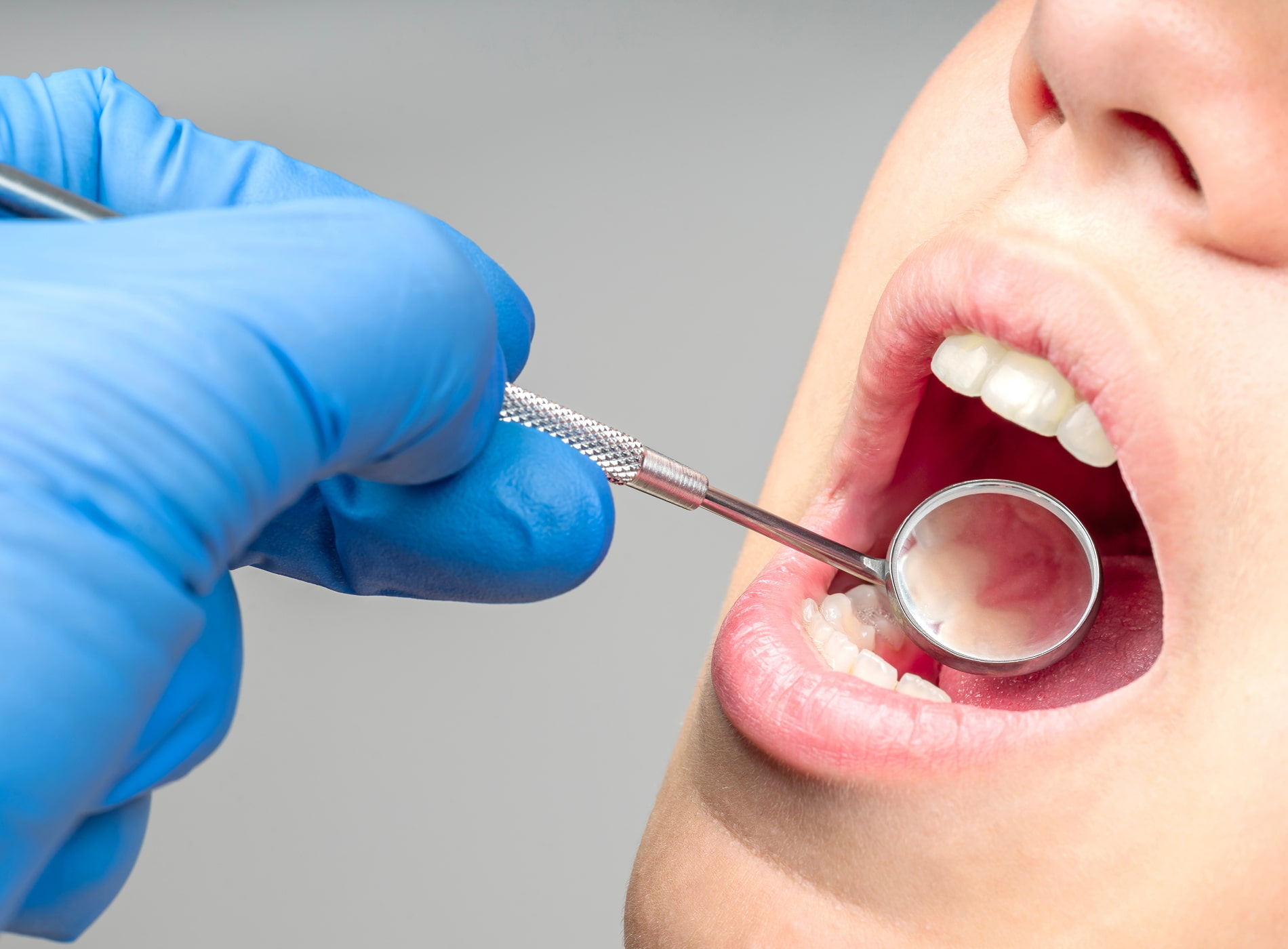 Cosmetic recontouring can fix minor imperfections in tooth shape, size, and gum line for a balanced smile.