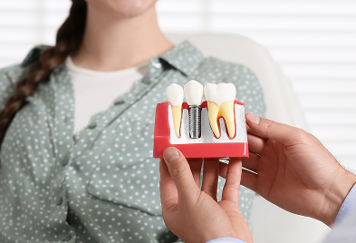 Smile restoration with single or full arch dental implants